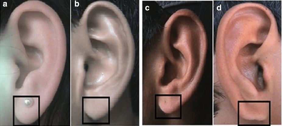 types of earlobe piercings