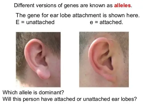 different types of earlobes